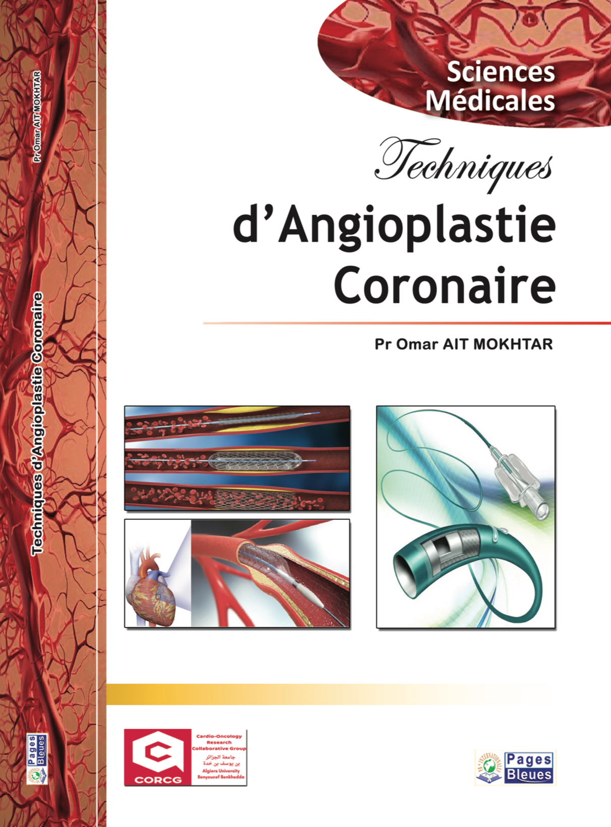 Techniques d’Angioplastie Coronaire